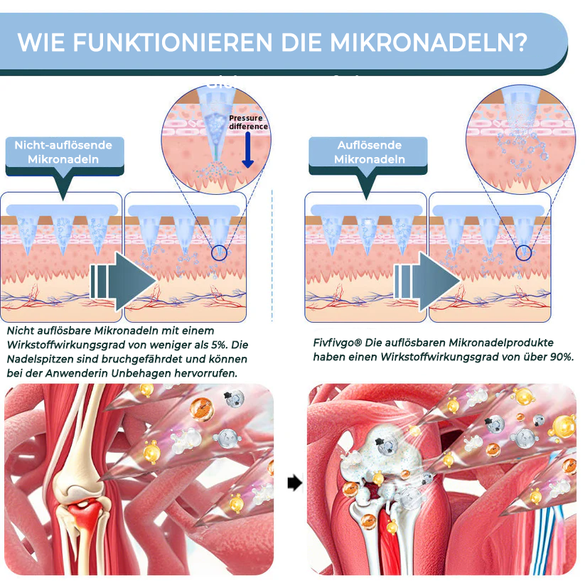 ✅ Offizieller Laden: Fivfivgo® Nano-Mikronadel-Gelenkpflaster
