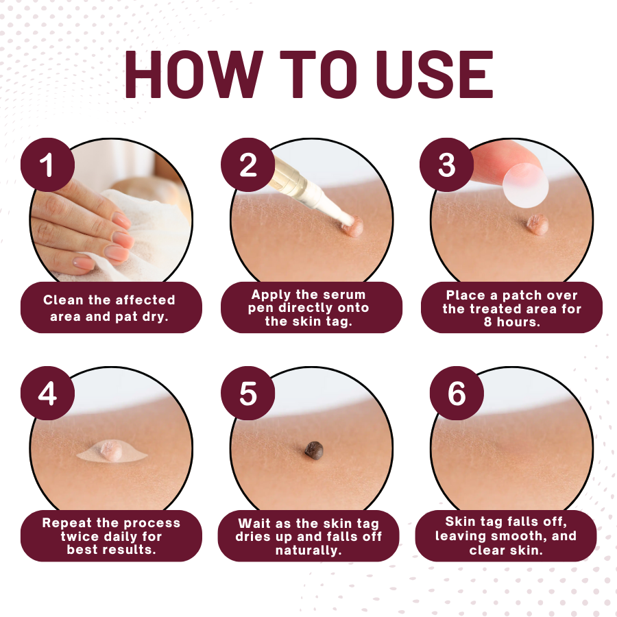 Fivfivgo™ Skin Tag Removal Stickers