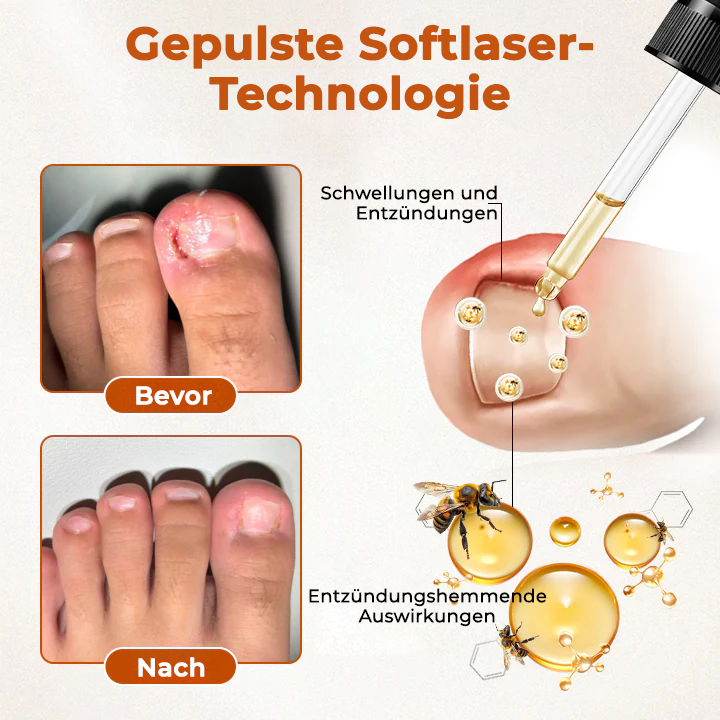 Fivfivgo® BeeShield Pilzlinderungstropfen