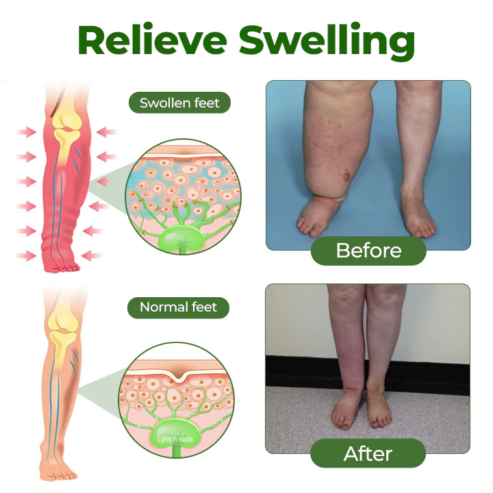 NovaRX® FluidEase Leg Therapy Edema Cream