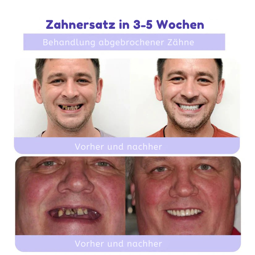 Fivfivgo™ Zahnrestauration Mineralisches Puder