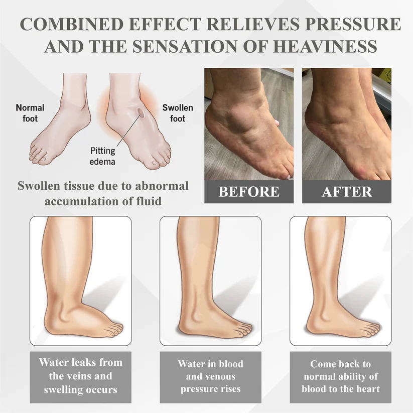 Bikenda® RedHeat EMS EdemaDrain Leg Massager