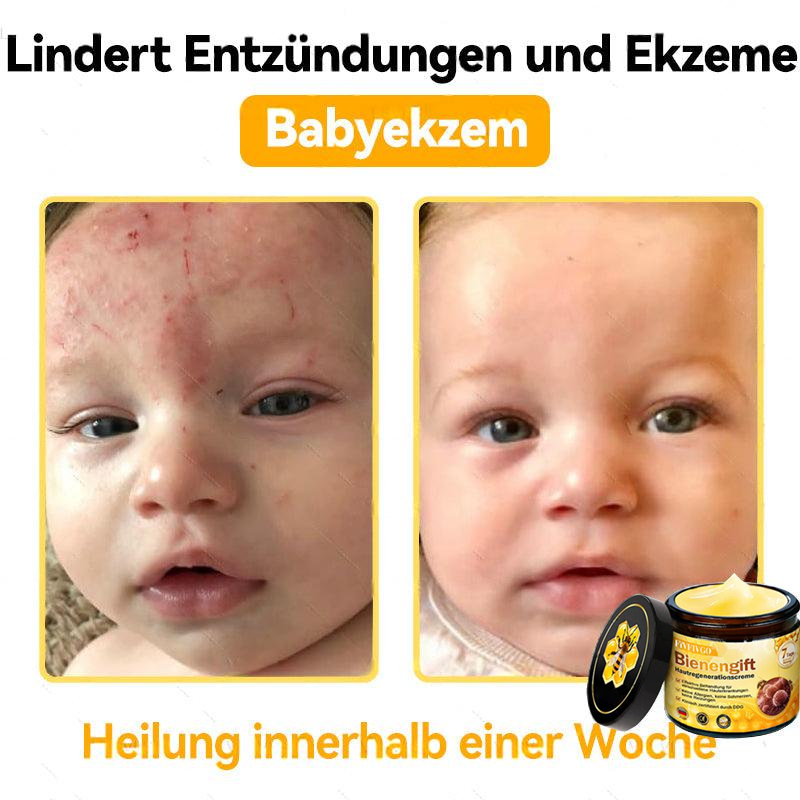 Fivfivgo™ Bienengift Hautregenerationscreme