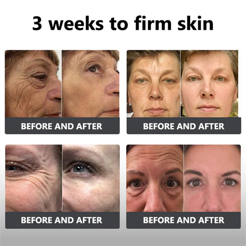 Fivfivgo™ Flüssiges Peptid-Peeling-Essenz