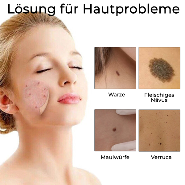 Fivfivgo™ Laser-Punkt-Entfernungsstift