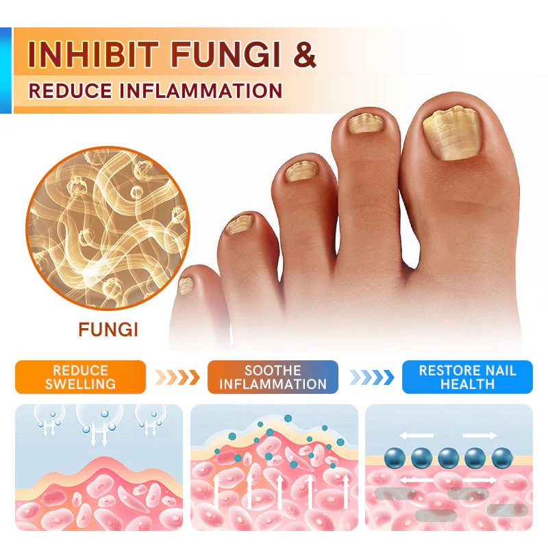 Fivfivgo™ Psoriasis Treatment Cream