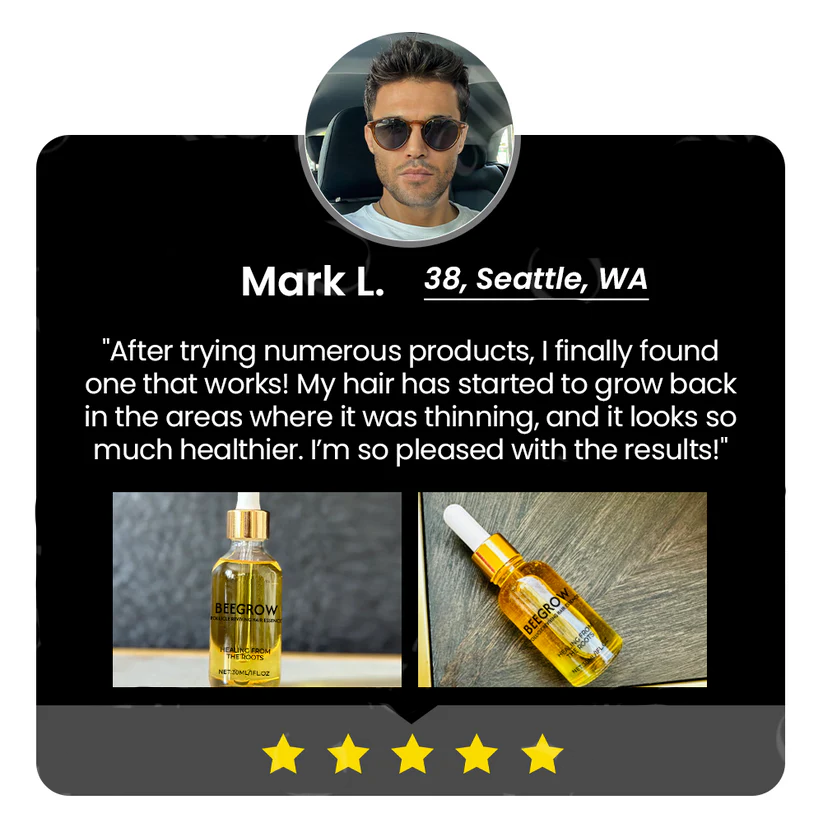✅Offizieller Shop: Fivfivgo™ BeeGrow Follicle Reviving Hair Essence 🌿 Anerkannt von AHLA & USP (klinisch erwiesen, um Haarfollikel zu aktivieren, die Gesundheit der Kopfhaut zu verbessern, Entzündungen zu reduzieren und Haarausfall zu verhindern)