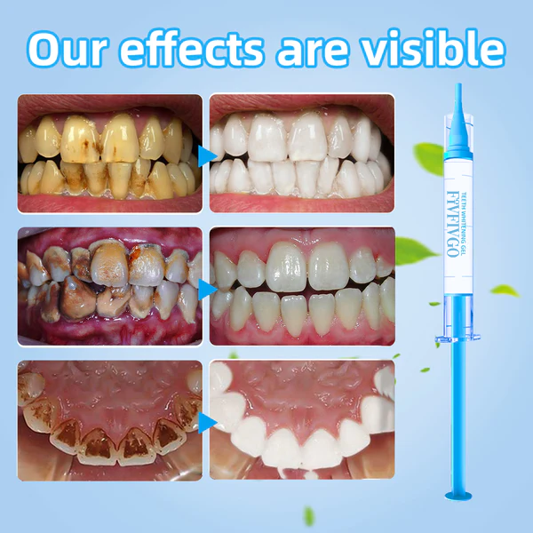 Fivfivgo™ Protéine de cartilage de requin Restauration dentaire et orale GE