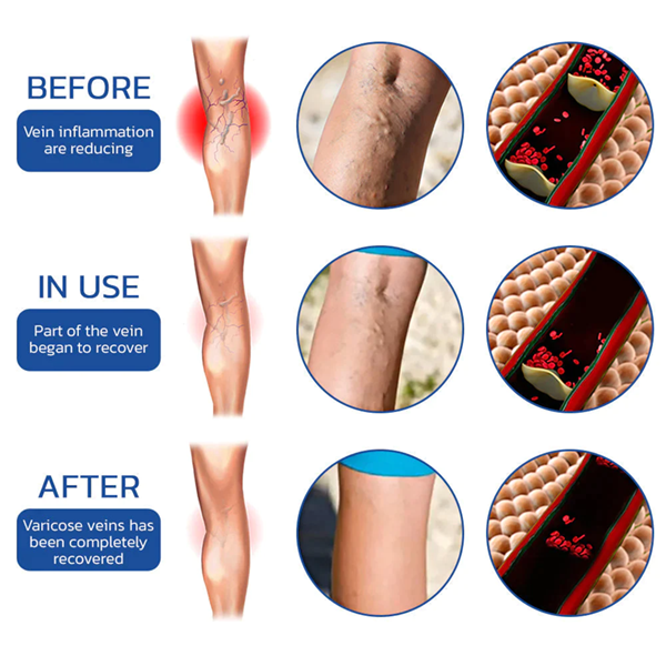 Fivfivgo™ UltraSLIM Tourmaline Ion Body Shaping Stretch Silk Stockings