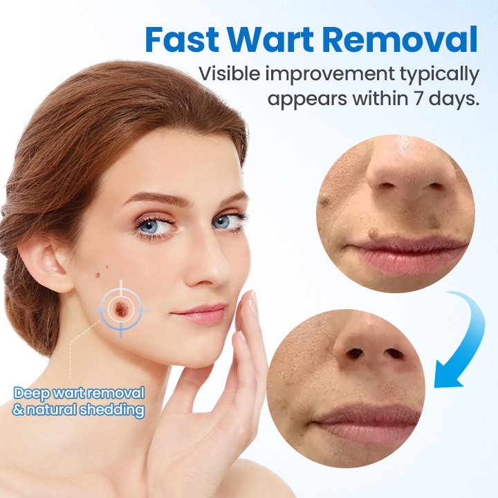 Fivfivgo® TagGone Wart Removal Cream