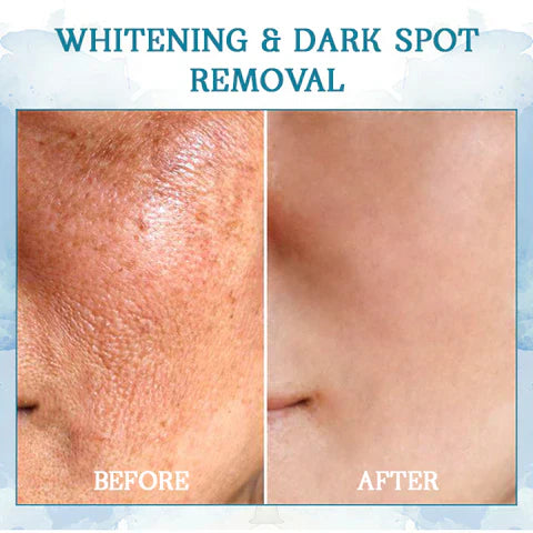 Fivfivgo™ B5 Hautstraffung Gel