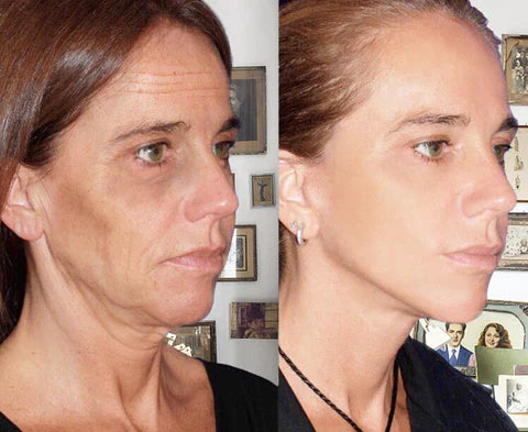 Fivfivgo™ Botox Facial Serum