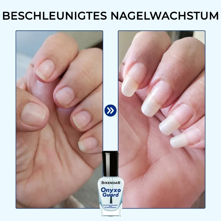 Bikenda® OnyxoGuard Wachstum der Nägel und Reparaturserum