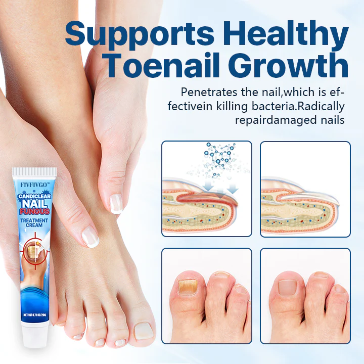 Fivfivgo™ Candiclear Nail Fungus Treatment Cream