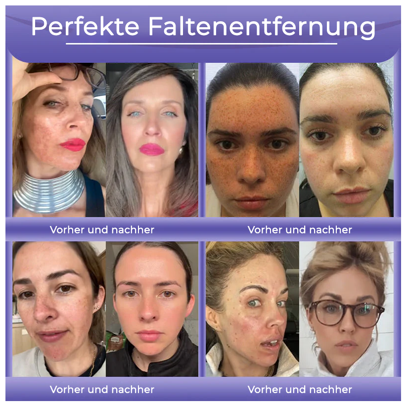 Fivfivgo® Anti-Falten-Hautcreme zum Entfernen von Falten, Straffen der Haut, Aufhellen - Last Day Sale🔥90% OFF