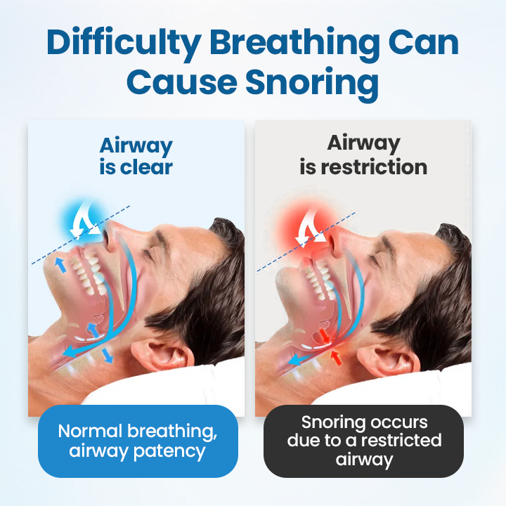 Fivfivgo® SnoreLess Nasal Breather