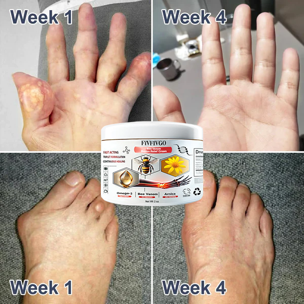 Fivfivgo™ Bee Venom Bunion Relief Cream