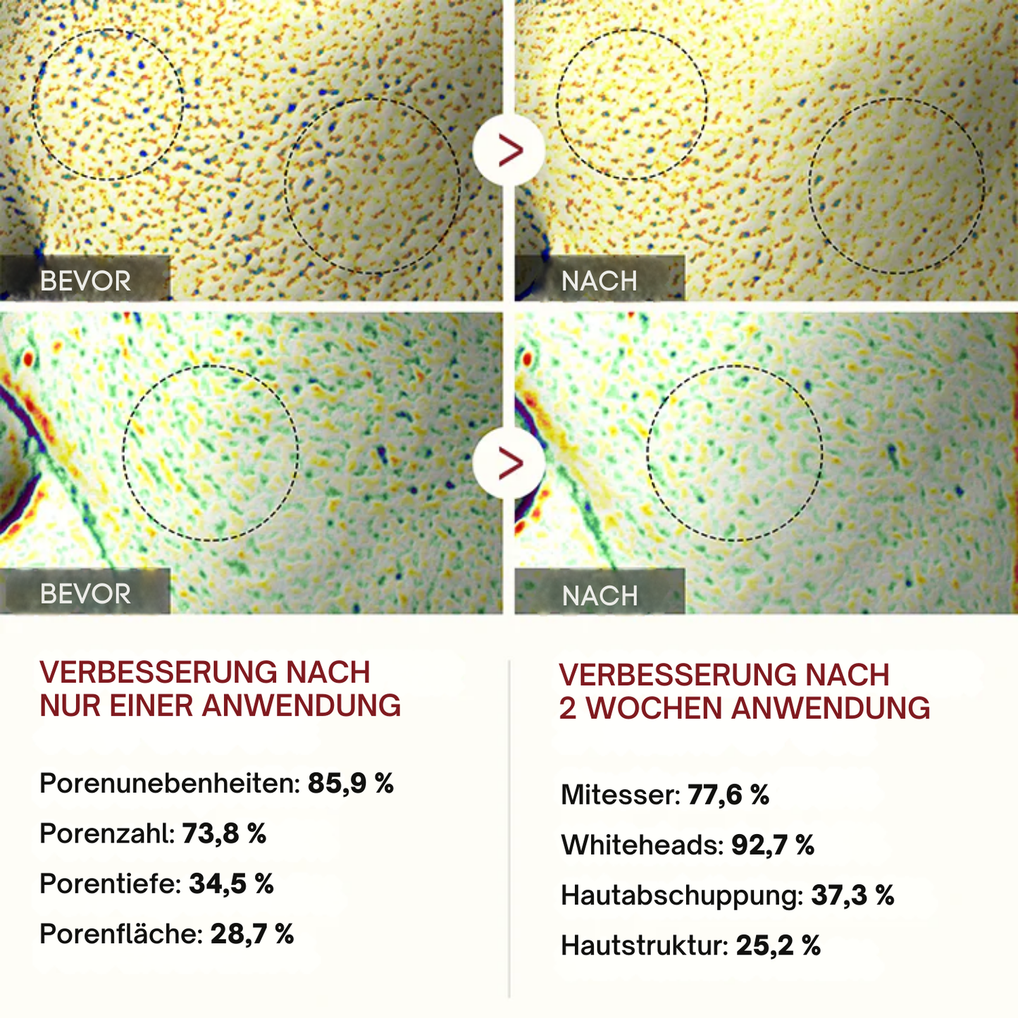 Fivfivgo® Peel-Schuss-Glühen Schwarzem Reis Ampulle