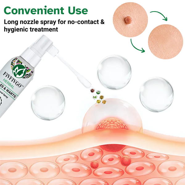 Fivfivgo™ Herbal Moles & Warts Removal Spray