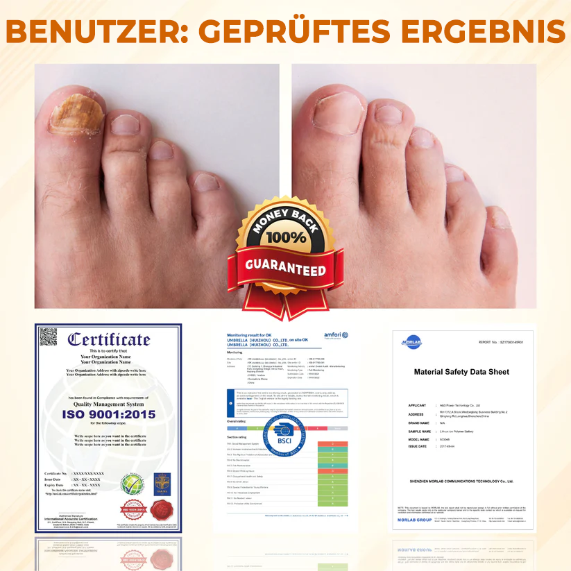 Fivfivgo® Fungiclear Bienen Therapie Nagelspray