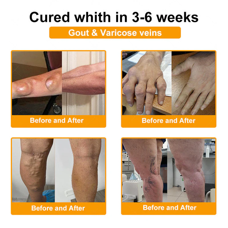 NovaRX®  Bee Venom Pain-Relief Joint Soothing Spray