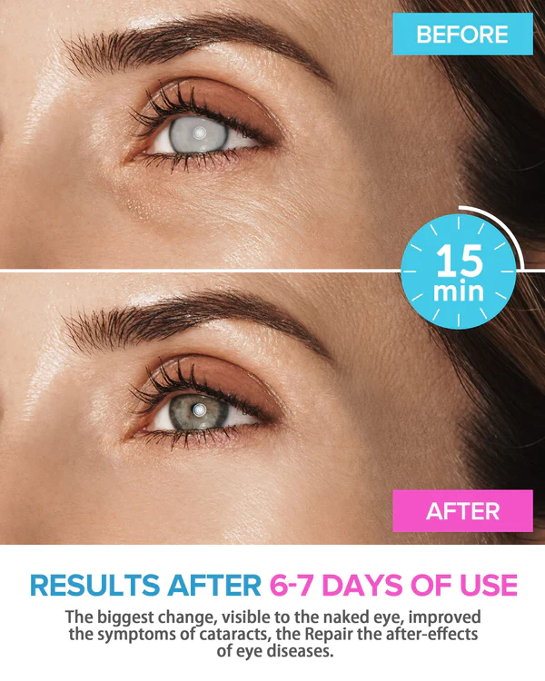 Fivfivgo™ REBRIGHT Natural Herbal Steam Eye Mask
