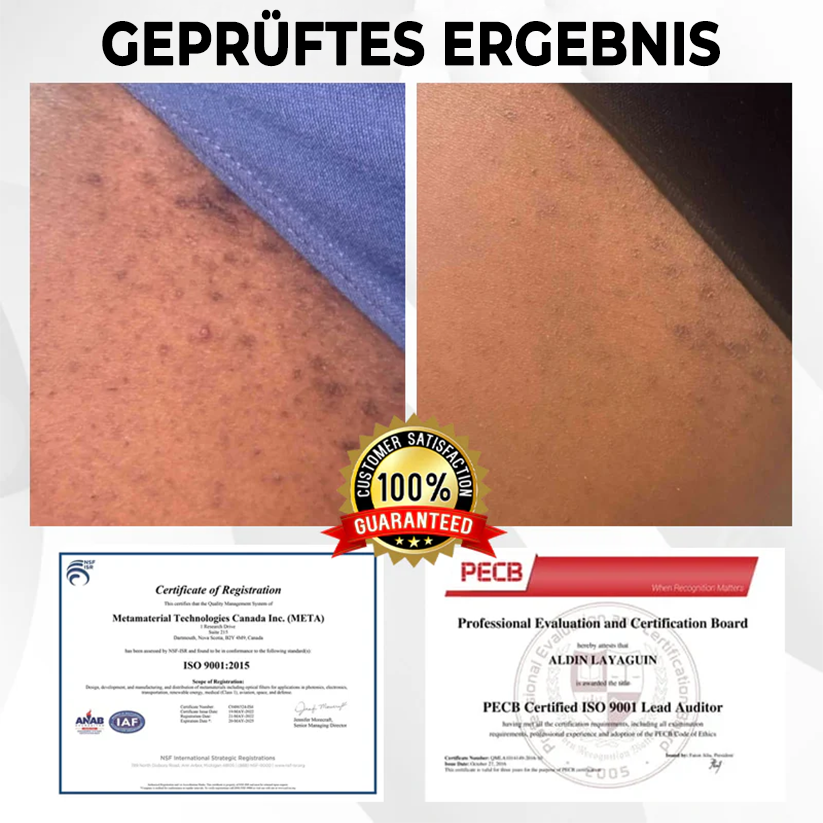 Fivfivgo® ManGuard HPV WART-Heilcreme