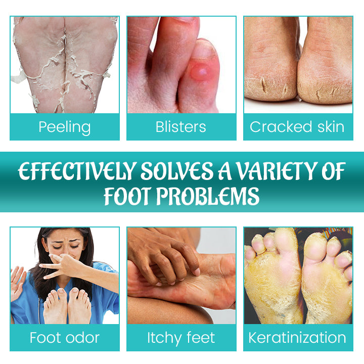 Fivfivgo™ FreshStride Advanced Antiperspirant Foot Care Spray