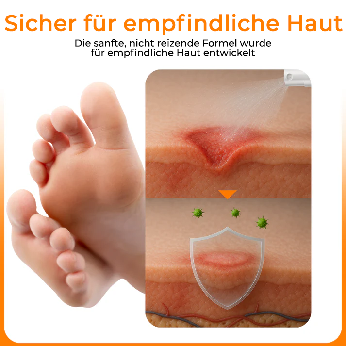 Bikenda® VenHeal Bienengift Diabetiker-Wundspray