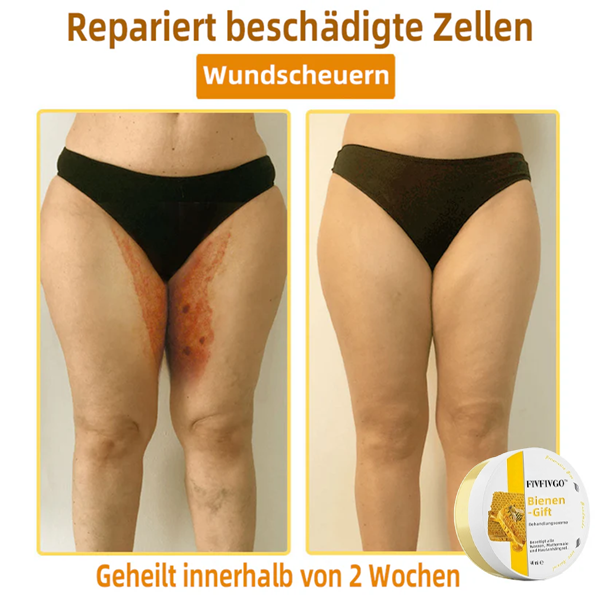 Fivfivgo™ Bienengift-Therapie-Creme