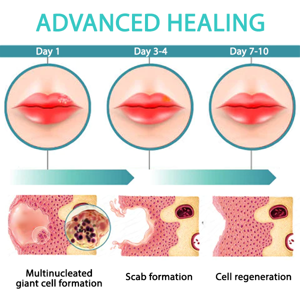 Fivfivgo™ Fieberblasen-Creme