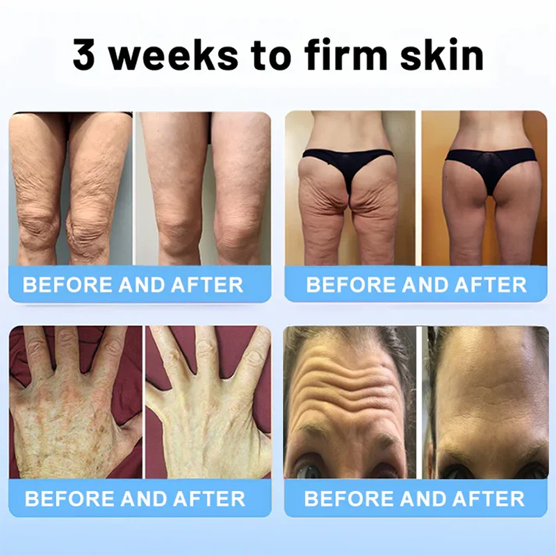 Fivfivgo™ Wrinkle Removel Cream (Address Crepe & Sagging)