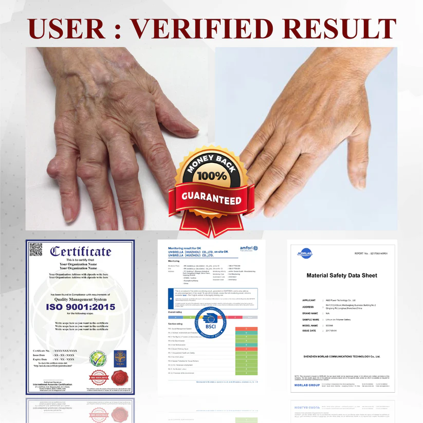 Fivfivgo™ Rosskastanie Arthritis-Massagecreme
