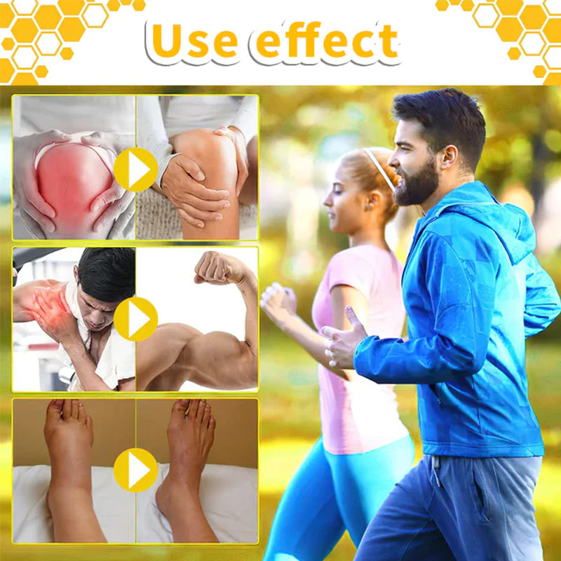 Fivfivgo™ Bienengift Schmerz- und Knochenheilungscreme (Neuseeländischer Rindfleischextrakt - Spezialisiert auf orthopädische Erkrankungen und Arthritisschmerzen)