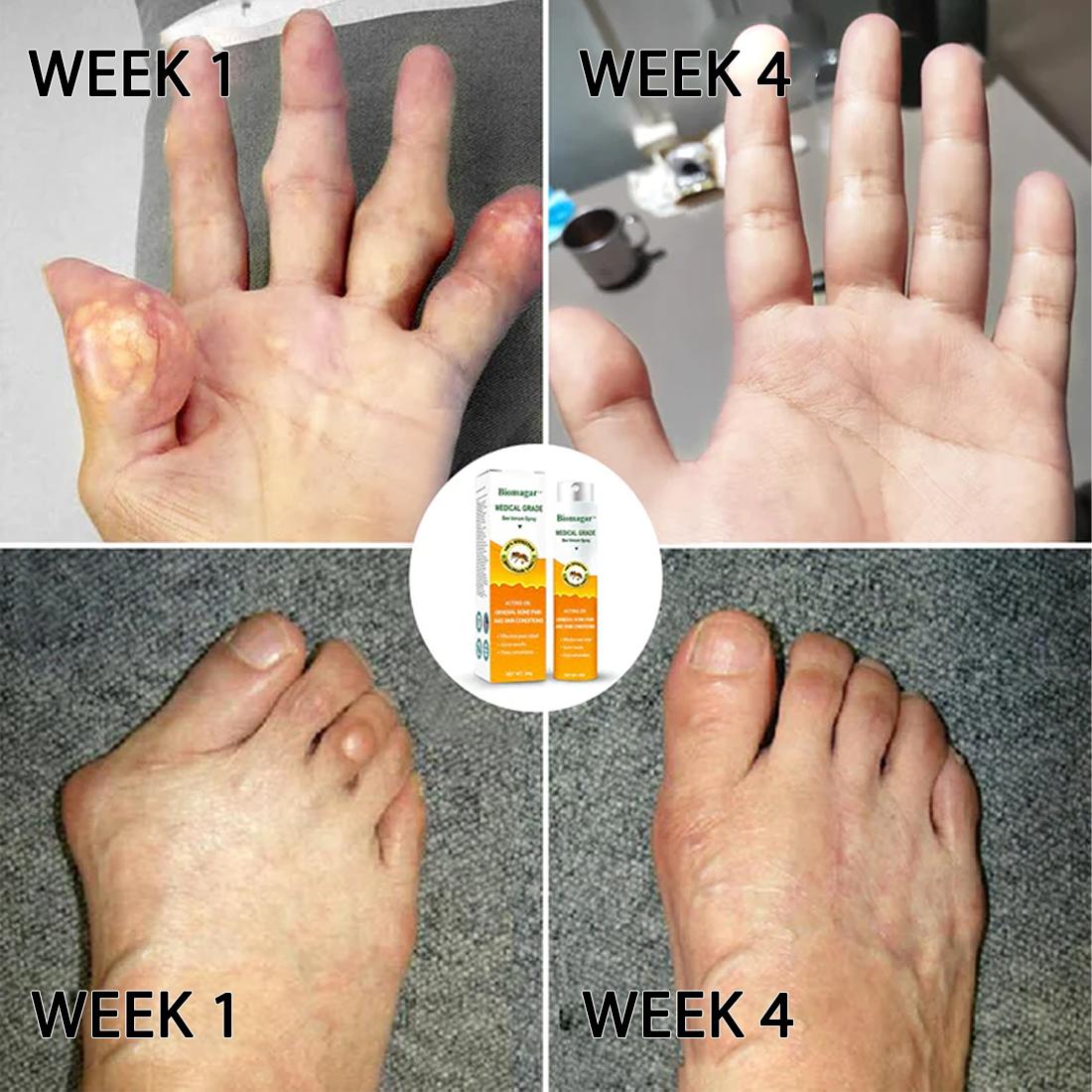 Fivfivgo™ Bienengift-Spray in medizinischer Qualität