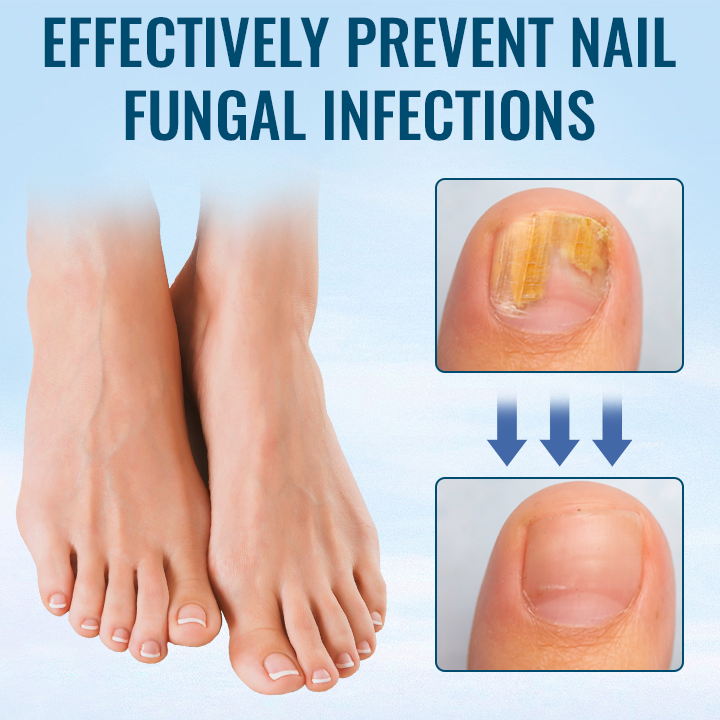 Fivfivgo™ Anti-Paronychia Nail Repairing Gel