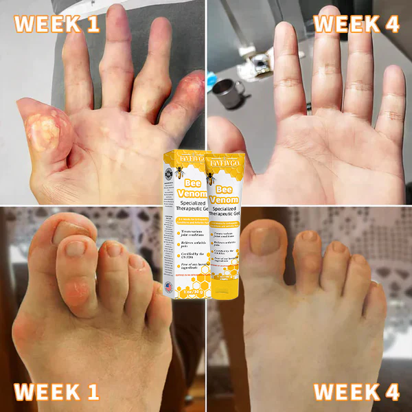 Fivfivgo™ Honey Bee Venom Joint Therapy Pain Relief Gel