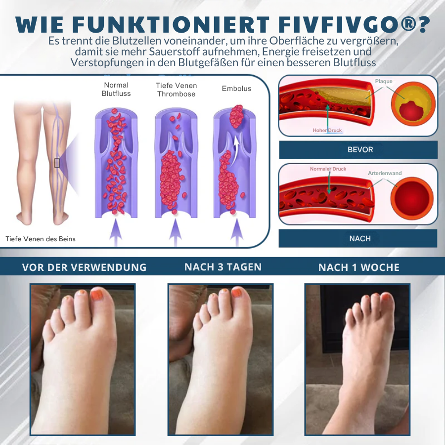 Fivfivgo® Schwarzkümmel Ödeme lindernde Kräutercreme