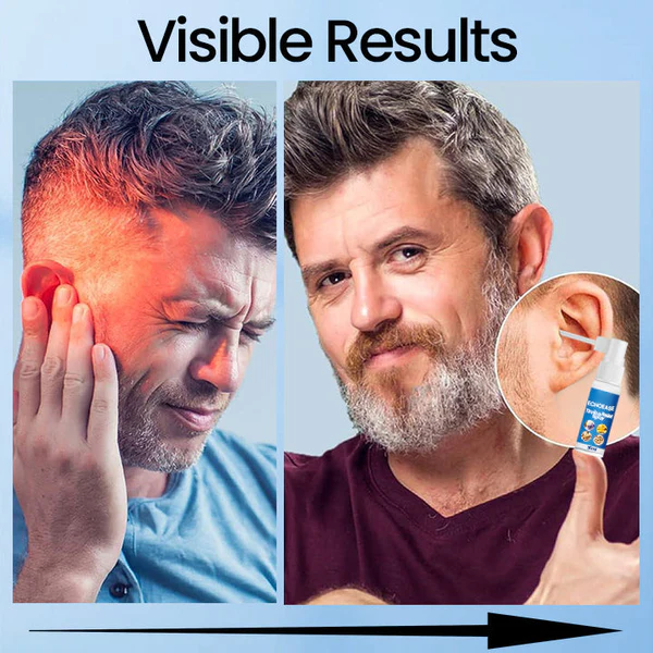 Fivfivgo™ EchoEase Tinnitus Relief Spray