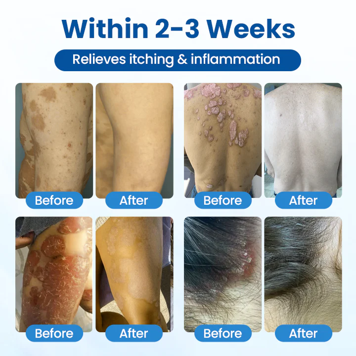 Fivfivgo® Magnesium Herbal Treatment Spray