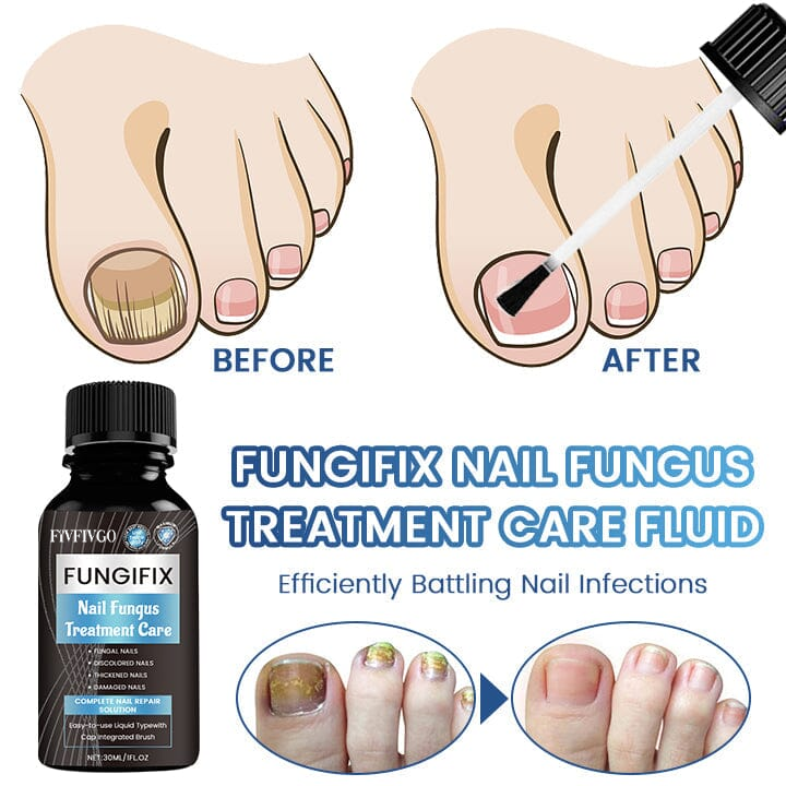 Fivfivgo™ FungiFix Nagelpilz-Behandlung Pflegeflüssigkeit