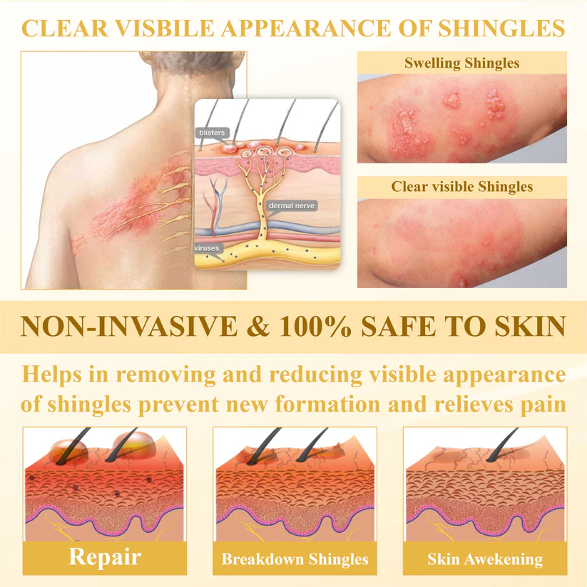 Fivfivgo® NervoRelief Shingles Healing Ointment