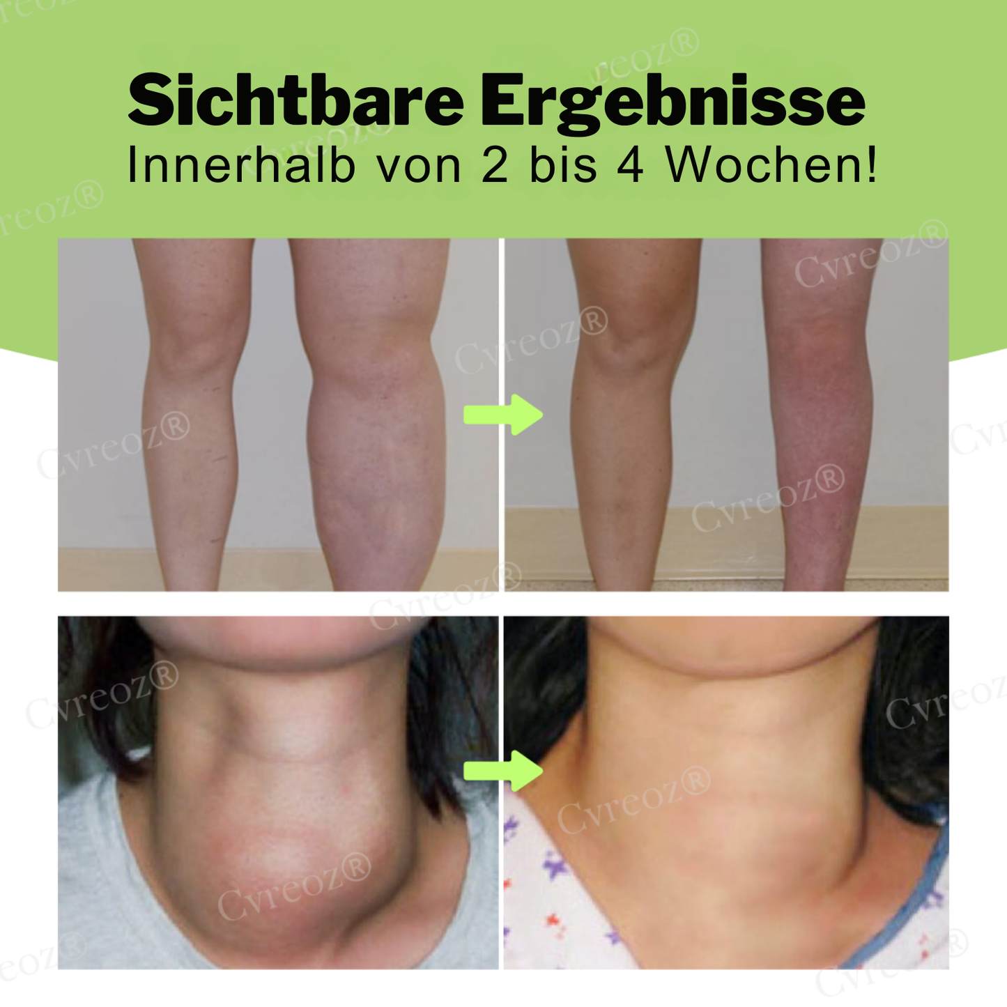 Fivfivgo® Kräuter-lymphatisch-Entgiftungscreme