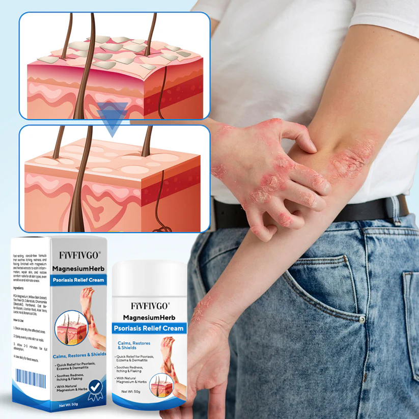 Fivfivgo® MagnesiumHerb Psoriasis Relief Cream