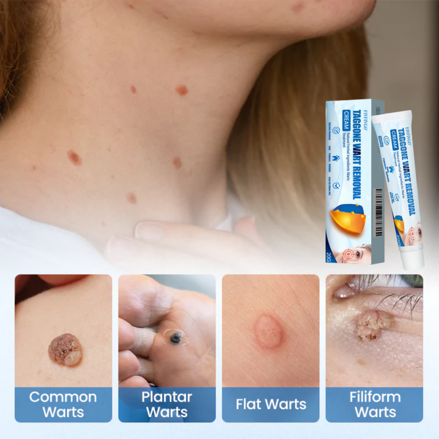 Fivfivgo® TagGone Wart Removal Cream