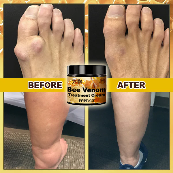 Fivfivgo™ Arthritisbehandlung Bienengiftcreme