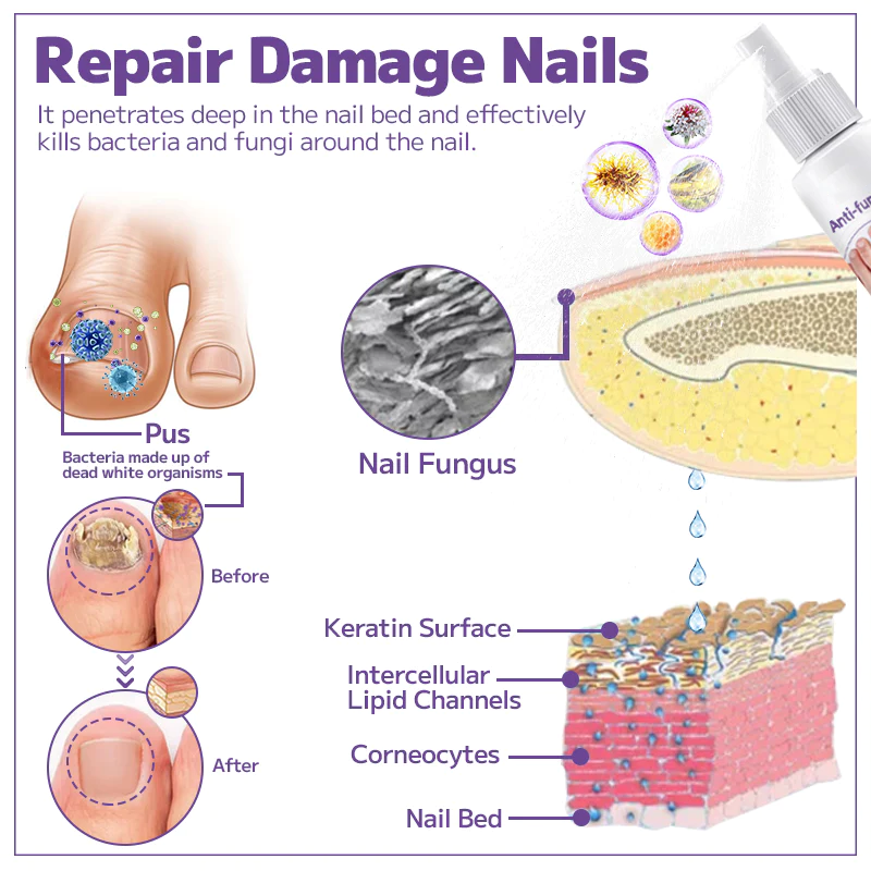 Fivfivgo™ Anti-fungal Nail Spray
