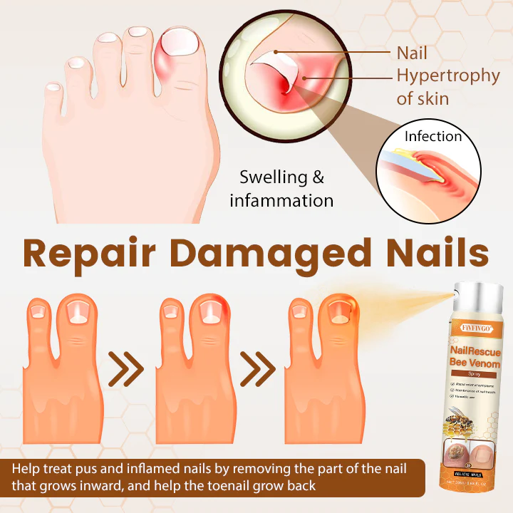 Fivfivgo® NailRescue Bee Venom Spray