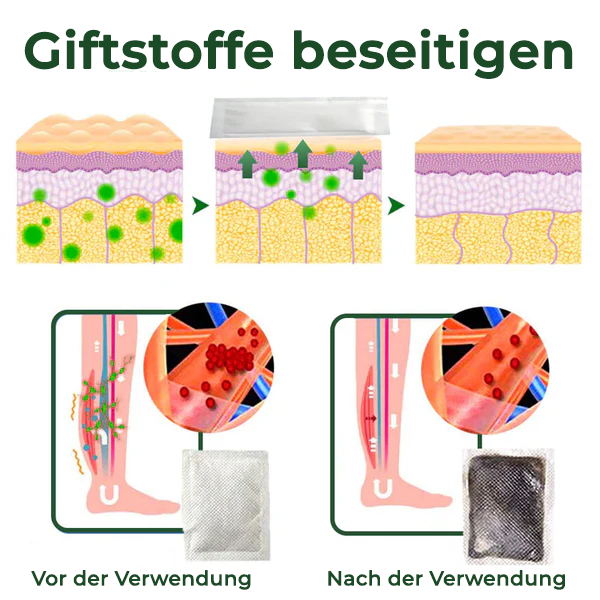 Cvreoz® Kräuter-Fußpflaster zur Linderung von Krampfadern