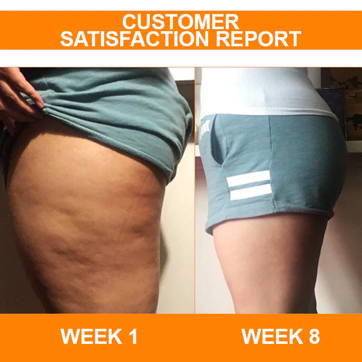 Fivfivgo™ AntiCellulite Firming Soap